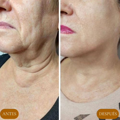 Olyse™ Reafirma Tu Piel y Confianza-100 ML