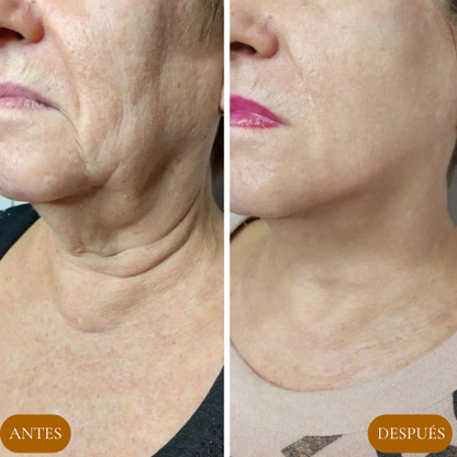 Olyse™ Reafirma Tu Piel y Confianza-100 ML