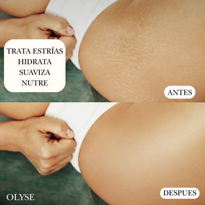 Olyse™ Un ritual para tu piel-100 ML