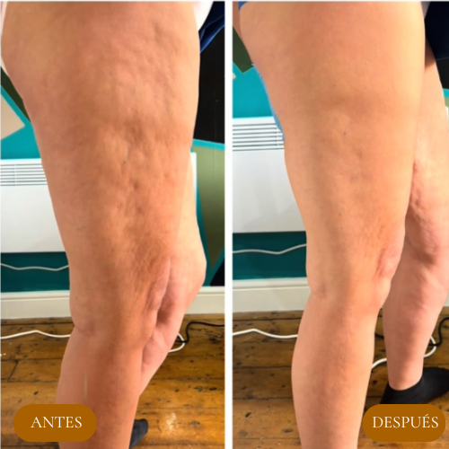 Olyse™ Reafirma Tu Piel y Confianza-100 ML