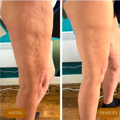 Olyse™ Reafirma Tu Piel y Confianza-100 ML